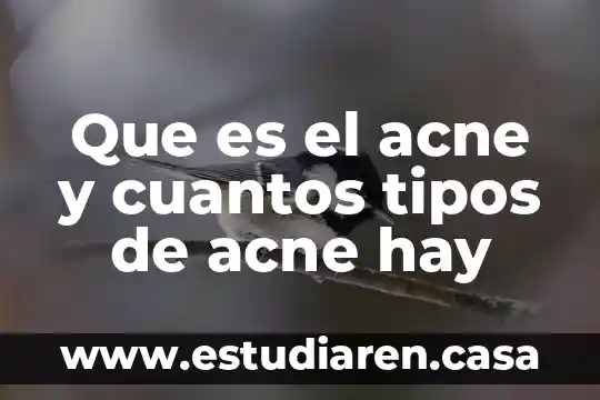 Que es el acne y cuantos tipos de acne hay
