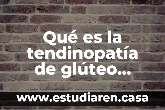 Que es el medio ubano 4 Qué es la tendinopatía de glúteo medio y TFL